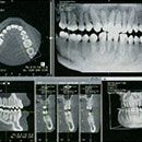 CT撮影・検査・診断