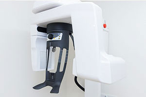 インプラントの疑問・不安など何でも聞いて下さい