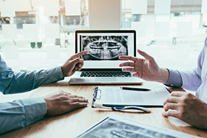 インプラントの疑問・不安など何でも聞いて下さい